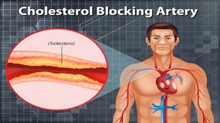 cholestrol free body, cholestrol control, how to control cholestrol,Signs of a healthy heart, How to know if you have low cholesterol, Key indicators of healthy cholesterol levels,