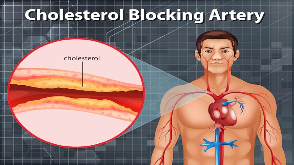 cholestrol free body, cholestrol control, how to control cholestrol,Signs of a healthy heart, How to know if you have low cholesterol, Key indicators of healthy cholesterol levels,