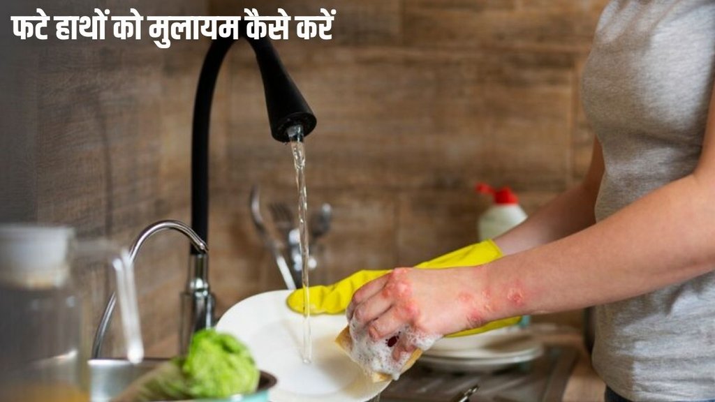 What to put on hands after washing dishes