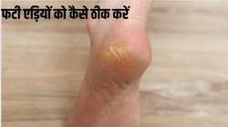 Good Night Tips: सर्दियों में फटी एड़ियों का इलाज हैं ये, रात को सोने से पहले फॉलो करें