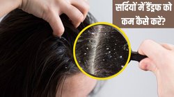 सर्दी में Dandruff की परेशानी को कम कैसे करें? बालों में रूसी से छुटकारा दिला देंगी ये 4 टिप्स