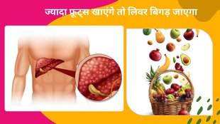 Excessive fruit consumption, liver problems, NAFLD, bloating, diarrhea, constipation, dental problems, blood sugar imbalances, balanced diet, healthcare professional,