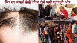 खुद गंजा, लोगों के सिर पर पर दवा लगाकर बाल उगाने का दावा करने वाले की खुली पोल, सच जानकर लोगों ने पकड़ लिया माथा