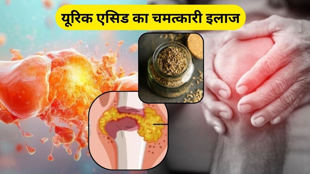 Uric Acid: जीरा से कैसे होगा यूरिक एसिड कंट्रोल