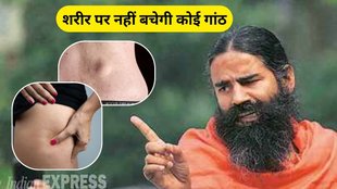 Ganth Ka Ilaj: बाबा रामदेव ने बताया गांठ का इलाज