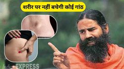 Ganth Ka Ilaj: शरीर से सारी गांठ खत्म कर देगा ये आयुर्वेदिक इलाज, बाबा रामदेव से जानिए कैसे करें उपयोग