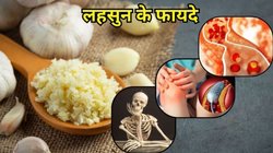 लहसुन की सिर्फ 2 कलियों से निकल जाएगा नसों में जमा सारा कोलेस्ट्रॉल, जानिए कैसे करना होगा इस्तेमाल