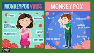 monkeypox symptoms and sign, Year Ender 2024, World Year Ender 2024, Nipah Virus, monkeypox,Monkeypox, Monkeypox Virus, WHO ,mpox viral infection,