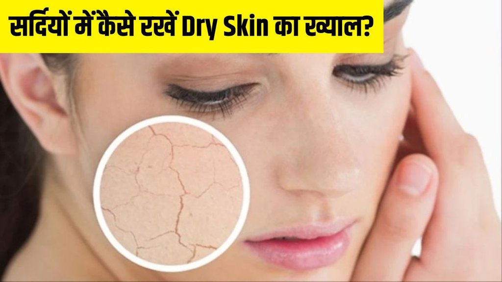 Dry Skin । Dry Skin remedy । winter skin care tips । Lifestyle news