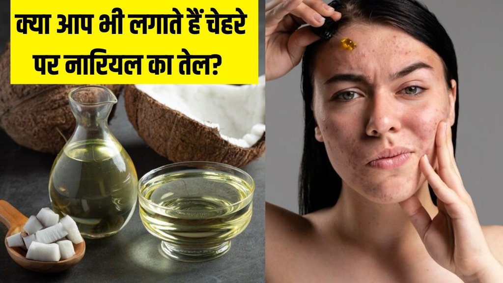 Coconut oil । Coconut oil and acne । Coconut oil on face
