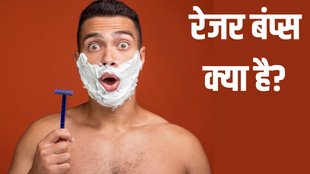 razor bumps । razor bumps meaning । what are razor bumps