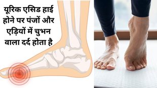 Uric Acid Home Remedy, drink For Uric Acid, uric acid, uric acid kaise kam kare, uric acid ke upay, uric acid ke gharelu upay