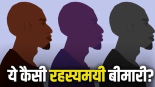 Maharashtra hair fall, Maharashtra sudden hair fall