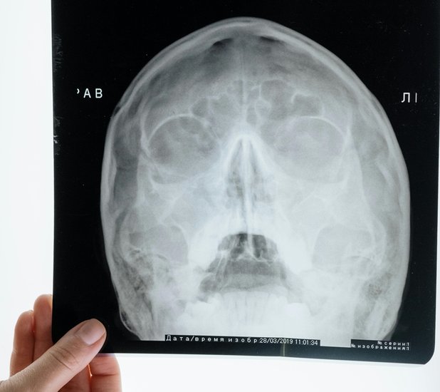 Yoga for sinus relief