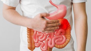 Foods that cause bloating, Bloating and dietary changes, Managing bloating through diet,