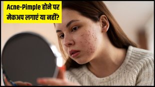 Makeup on acne prone skin । Skin care । Beauty Tips
