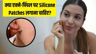 silicone patches । Pimple Patch । Acne remedy । Pimple remedies