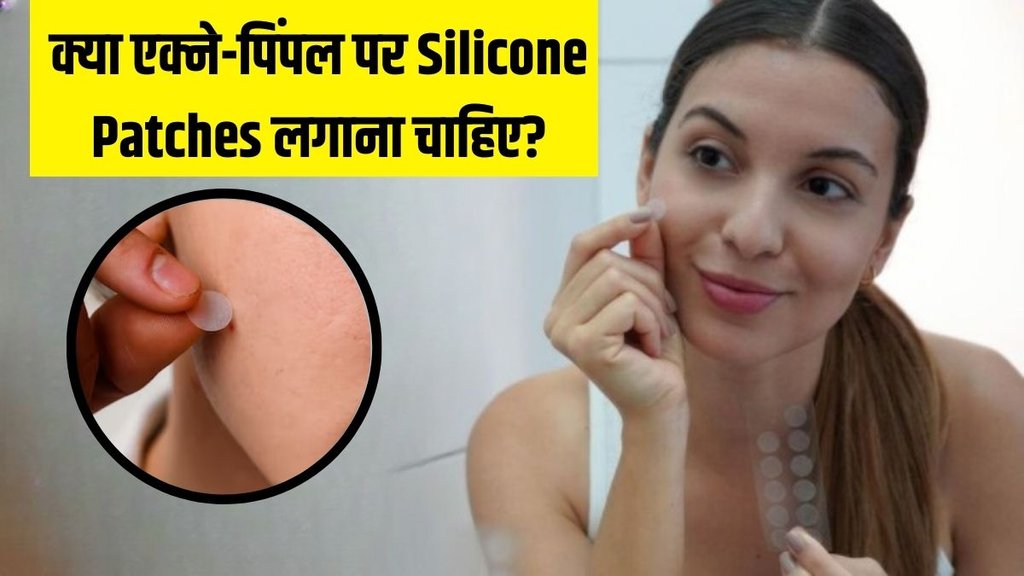 silicone patches । Pimple Patch । Acne remedy । Pimple remedies