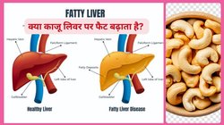 क्या फैटी लिवर के मरीज काजू खा सकते हैं? क्या Cashew के liver पर साइड इफेक्ट भी होते हैं, एक्सपर्ट से जानिए