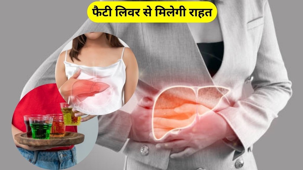 Fatty Liver Fatty Liver