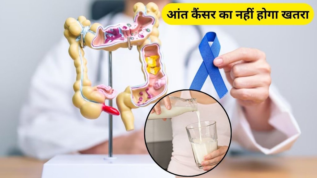 milk reduces risk of colon cancer: आंत कैंसर का नहीं होगा खतरा