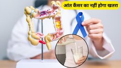 आंत के कैंसर का खतरा कम करेगा सिर्फ एक गिलास दूध, रिसर्च से जानिए कैसे?