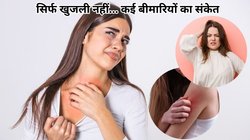 शरीर के कुछ हिस्सों में हो रही खुजली तो इन गंभीर बीमारियों का हो सकता है संकेत, नजरअंदाज करना पड़ेगा महंगा, जानिए कैसे
