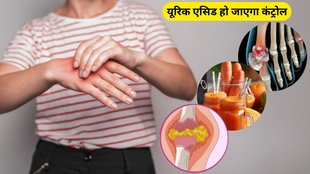 uric acid control