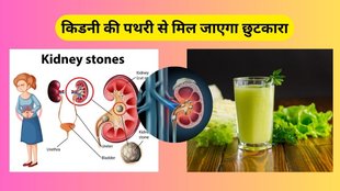 kidney stone dissolve juice
