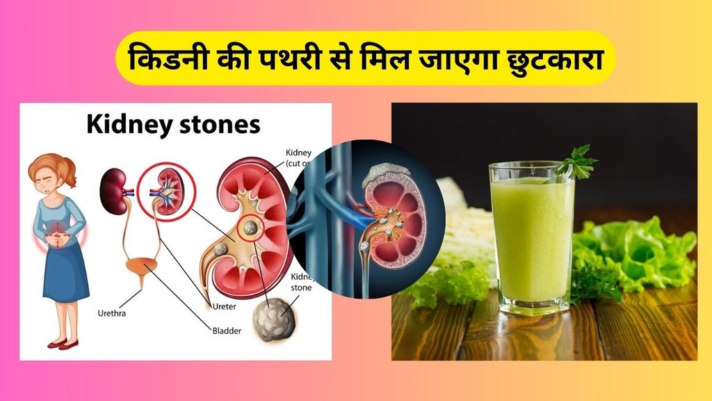 kidney stone dissolve juice