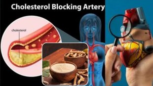 Cholesterol control, Lowering bad cholesterol, Foods for cholesterol management, Cholesterol lowering vegetables
