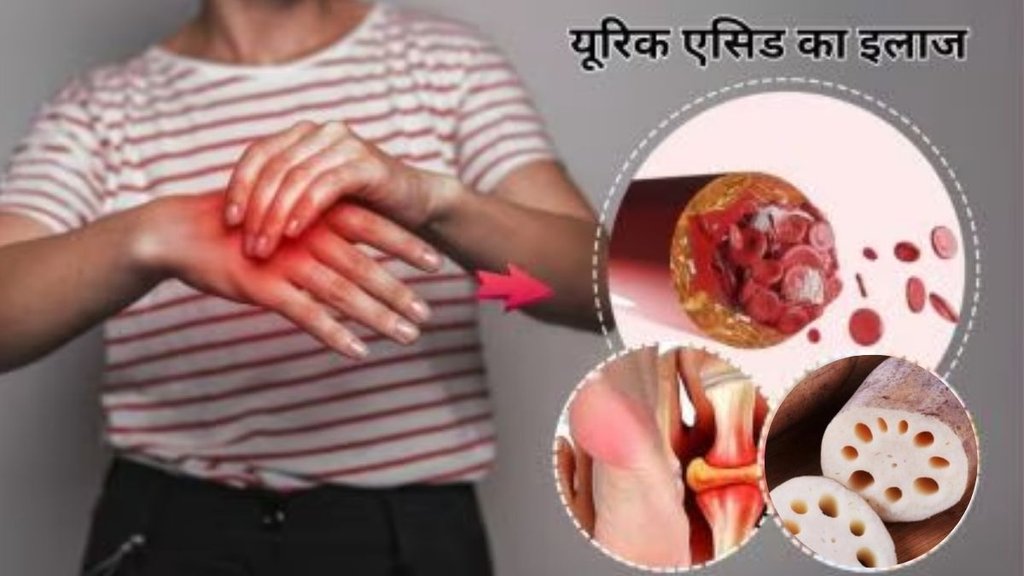 Lotus cucumber for uric acid