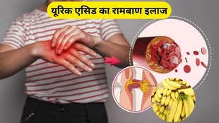 banana for uric acid control, banana for uric acid, kele ke fayde in hindi, kele ke fayde, uric acid ko kam kaise kare