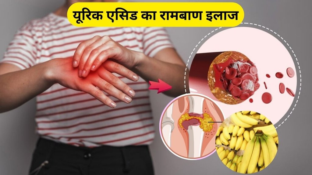 banana for uric acid control, banana for uric acid, kele ke fayde in hindi, kele ke fayde, uric acid ko kam kaise kare banana for uric acid control, banana for uric acid, kele ke fayde in hindi, kele ke fayde, uric acid ko kam kaise kare