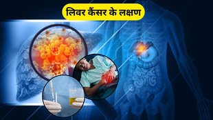 Liver Cancer Symptom