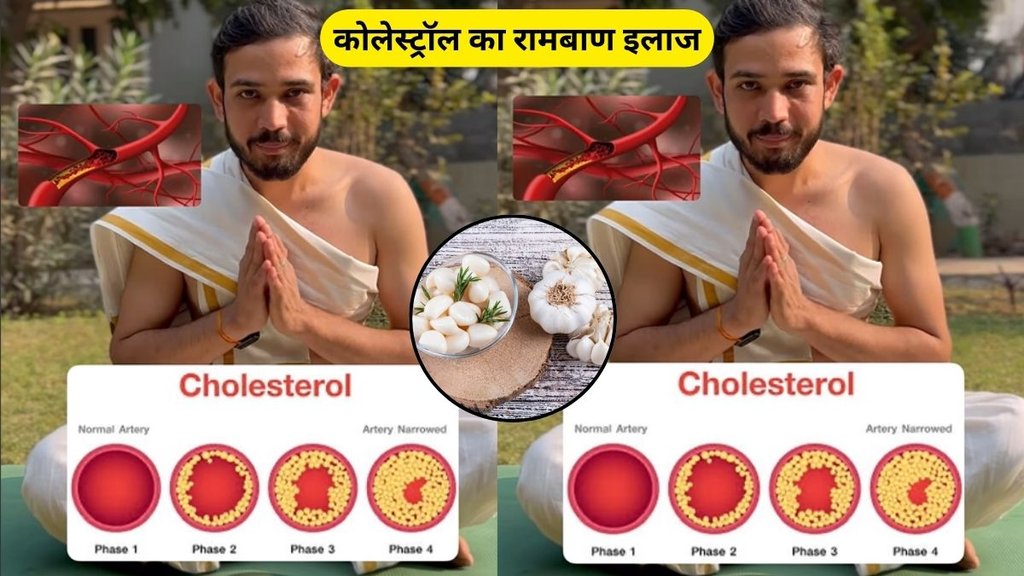 Garlic for cholesterol control