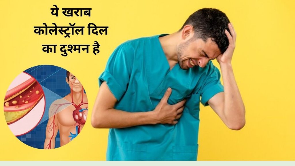 cholesterol, high cholesterol, cholesterol in young adults, high cholesterol in 20s and 30s, high cholesterol reasons