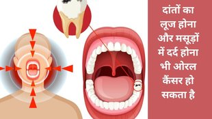 Mouth cancer early symptoms, Cancer, Health, mouth cancer, Mouth cancer, Mouth Cancer Symptoms, Oral Cancer Signs, Mouth Cancer Serious Symptoms,