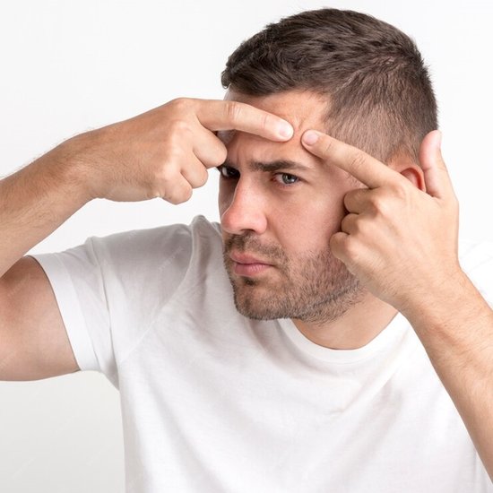 pimple on Forehead