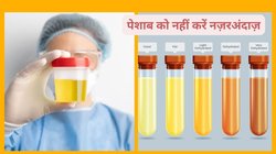 पेशाब में लगातार झाग दिखना इन 5 बीमारियों की हो सकती है दस्तक, यूरिन के रंग और बबल से तुरंत करें पहचान, टल जाएगा बीमारी का खतरा