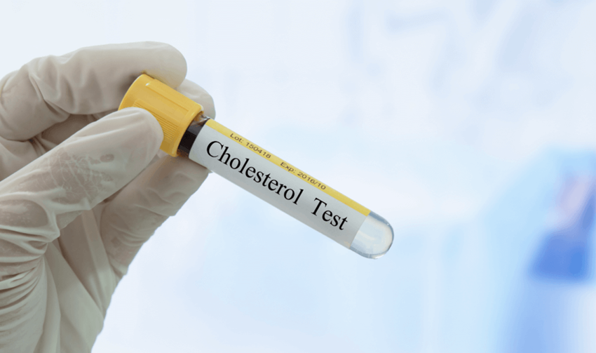 Cholesterol-Blood-test