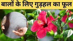 बालों के लिए अमृत है यह लाल फूल, बस इस तरह से कर लें उपयोग; डैंड्रफ का जड़ से हो जाएगा खात्म