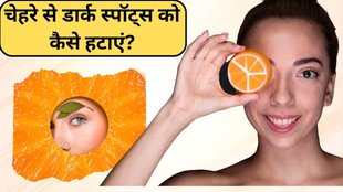 dark spots । dark spots on face