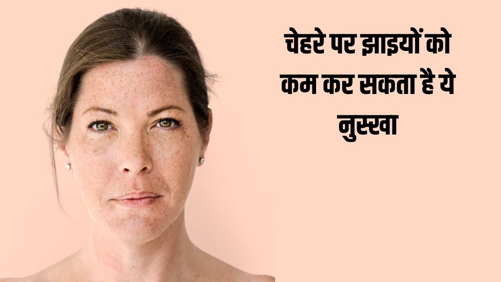 Pigmentation । Pigmentation tips । Hyperpigmentation