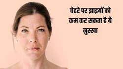 फिटकरी में मिलाकर लगा लें ये एक चीज, स्किन के डॉक्टर ने बताया चेहरे पर झाइयों को कम करने का आसान नुस्खा