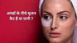 इन 5 बीमारियों की वजह से आंखों के नीचे आती है सूजन, पपोटे हर वक्त दिखते हैं फूले हुए, एक्सपर्ट से जानिए कैसे करें इस परेशानी का इलाज