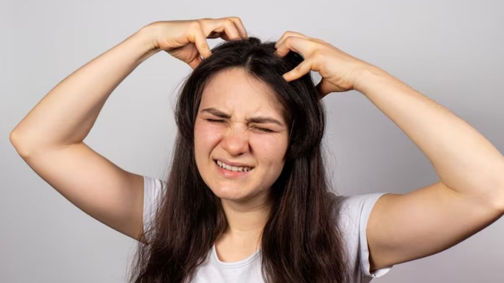 Habib Dandruff Home Remedy