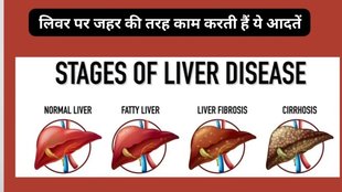 Fatty Liver ke karan, Fatty Liver ke karan in hindi, health tips, health news, health benefits, liver health, fatty liver