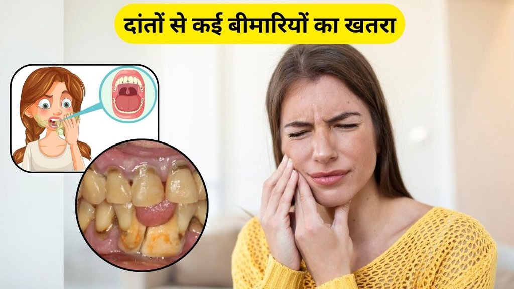 masoodo ki soojan ke gharelu upay, teeth pyorrhea, teeth, pyorrhea, teeth pyorrhea treatment in hindi, teeth pyorrhea treatment