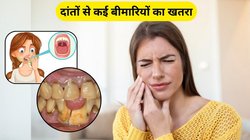 दांतों से खून और बार-बार फूल जाता है मसूड़ा तो इन 3 बीमारियों के हो सकते हैं शिकार, डॉक्टर से जानें कैसे करें बचाव